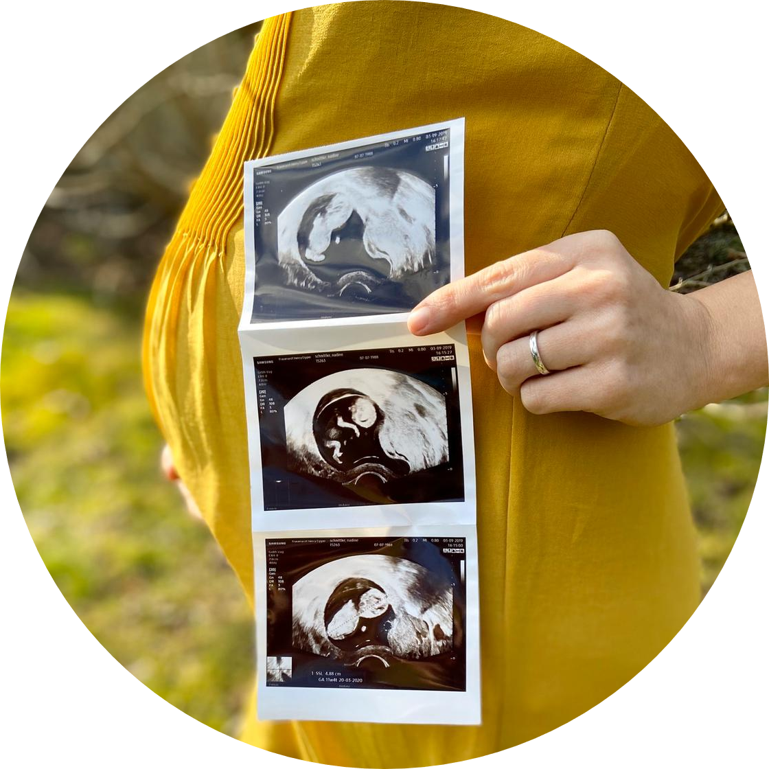 Nadine Schnittke, Bernauerin mit Herz